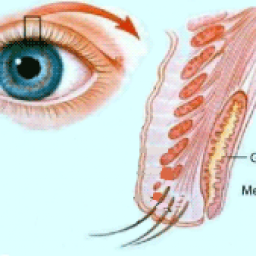 Glande de Meibomius